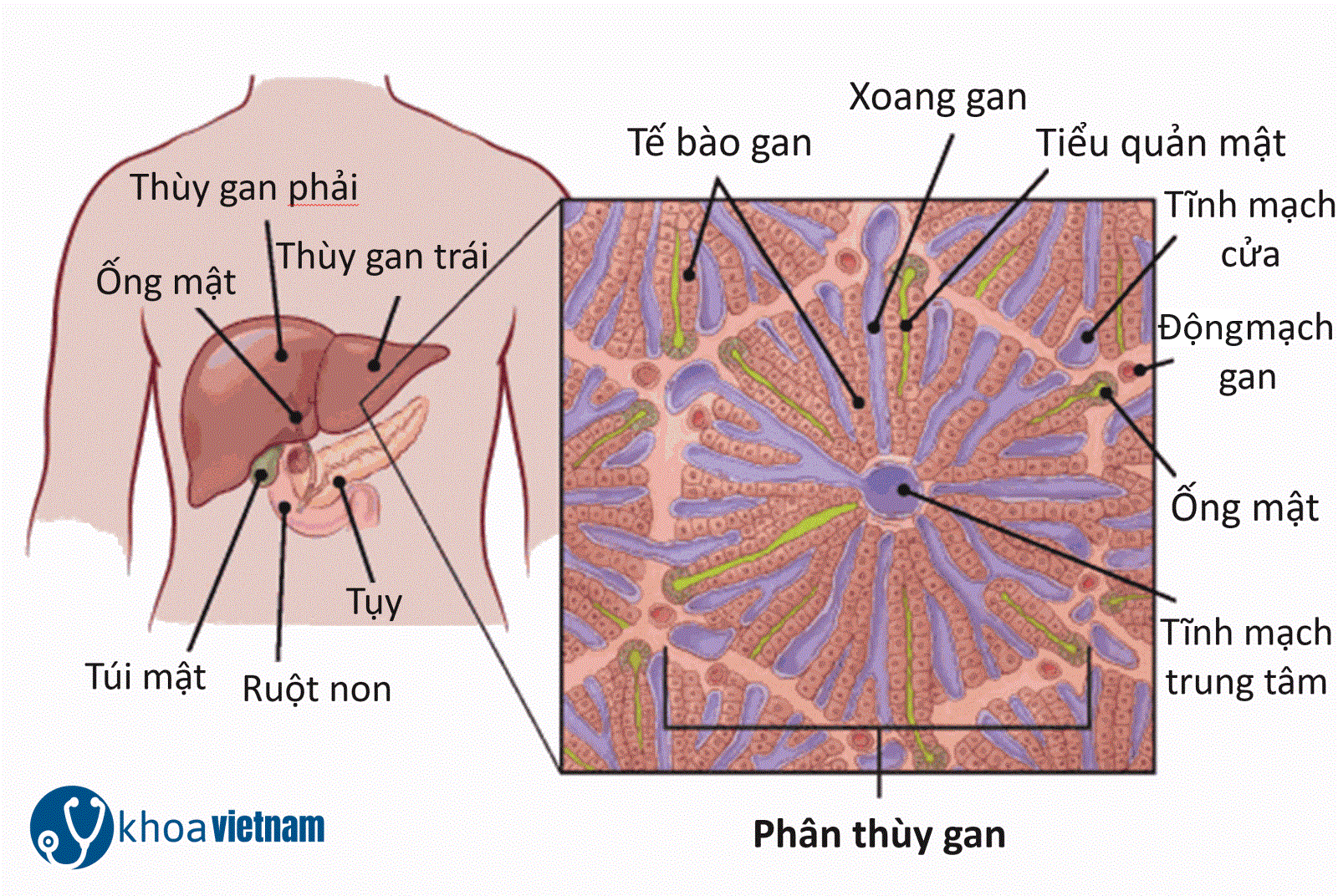 Ung Thư Gan Nguyên Phát 1